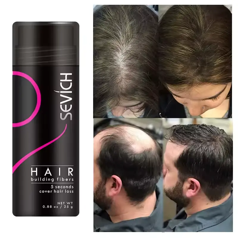 Adglamful Hair Fiber Kit 15g, Unisex, Instantly Adds Volume, Conceals Thinning Areas, and Fills Hairline for a Fuller Look.